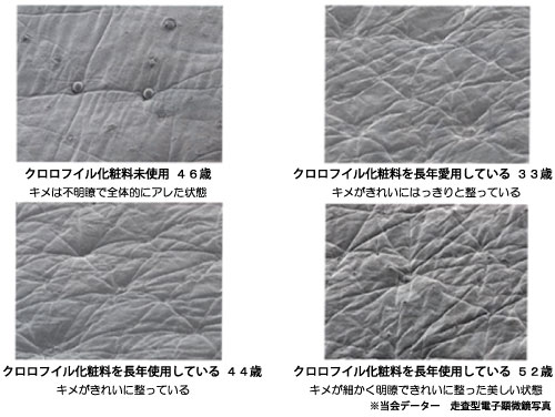 当会データー 走査型電子顕微鏡写真